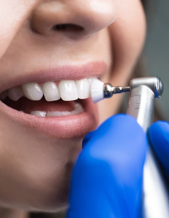 Close up of a dental patient having their teeth professionally cleaned