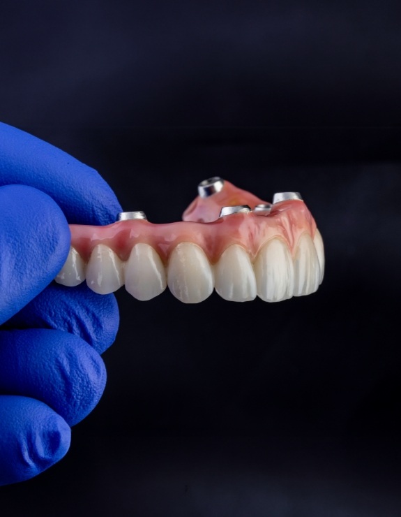 Gloved hand holding an implant denture