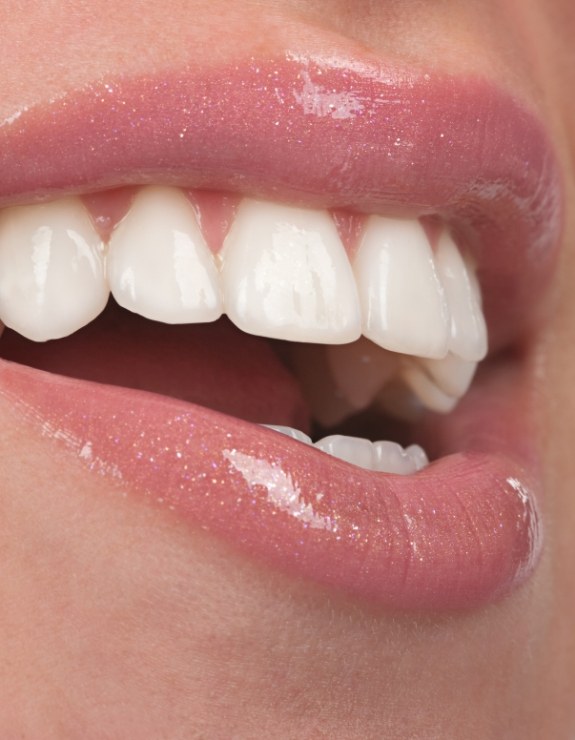 Close up of smile with flawless straight white teeth