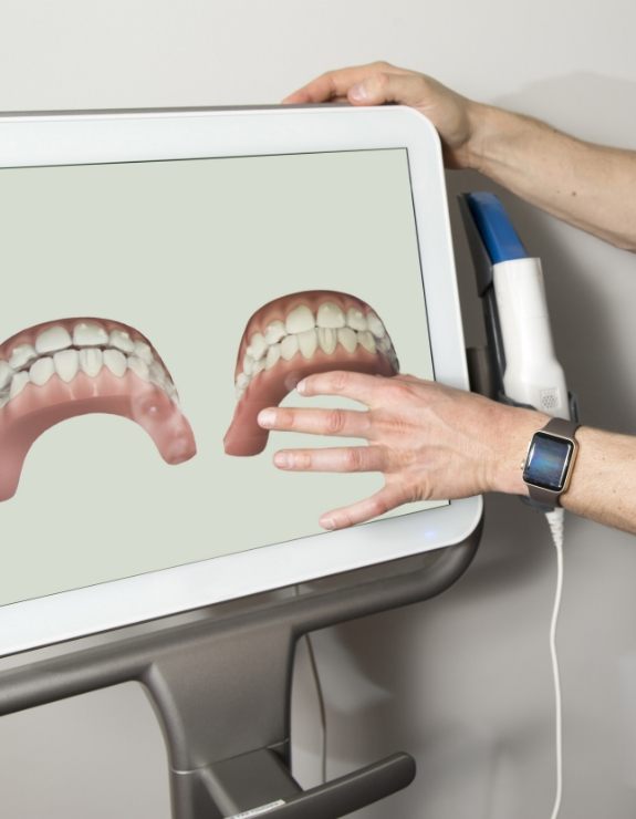 Dentist pointing to monitor with digital impressions of teeth