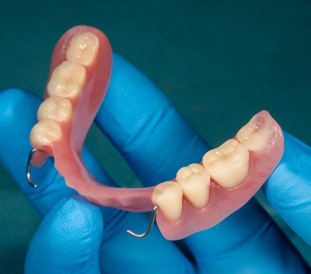 Gloved hand holding a partial denture