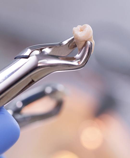 Extracted tooth held by forceps