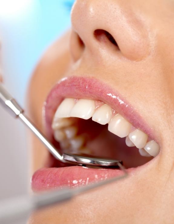 Close up of dental patient receiving a dental exam