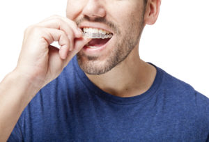 Young man wearing clear braces.