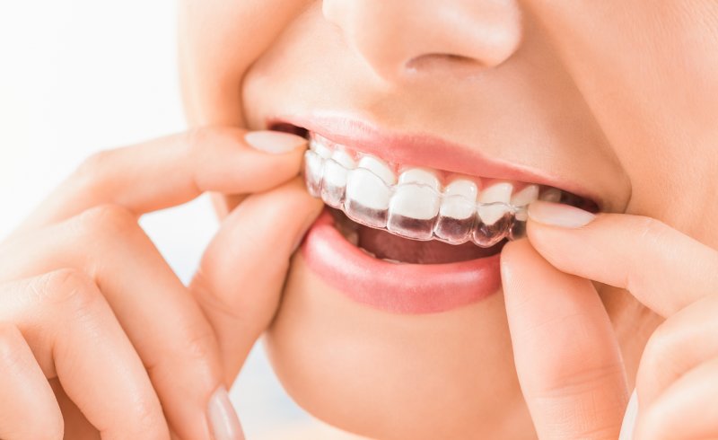 Closeup of smiling woman putting on Invisalign retainer