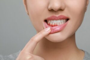 Woman pointing to red, inflamed gums.