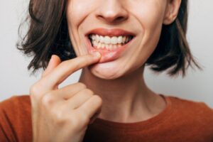 Woman pulling lip down to show off gums.